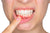 Causes and Solutions for Gums Bleeding: Top Tips to Maintain Oral Health