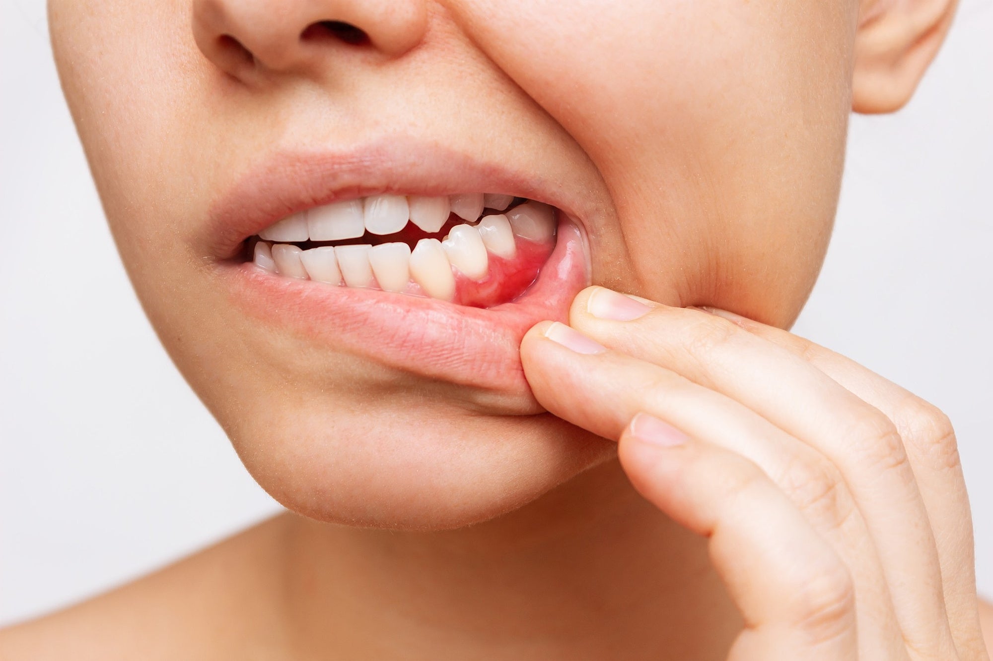 Bleeding of Gums: Warning Signs and Treatment Options