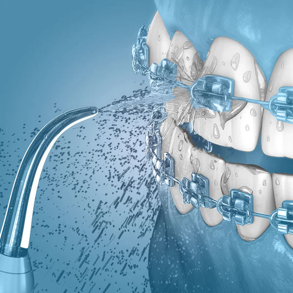 Water Flosser: The Easiest Way to Floss